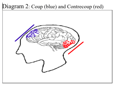 brain injury pt 2 diagram2