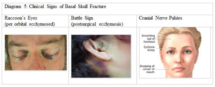 brain injury pt 2 diagram5